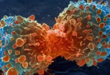 Nowy test krwi wykrywa raka i wskazuje na jego położenie w organizmie! rak_cancer.jpg